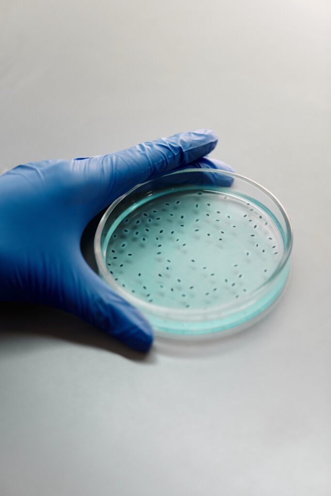 Lab test on bacteria